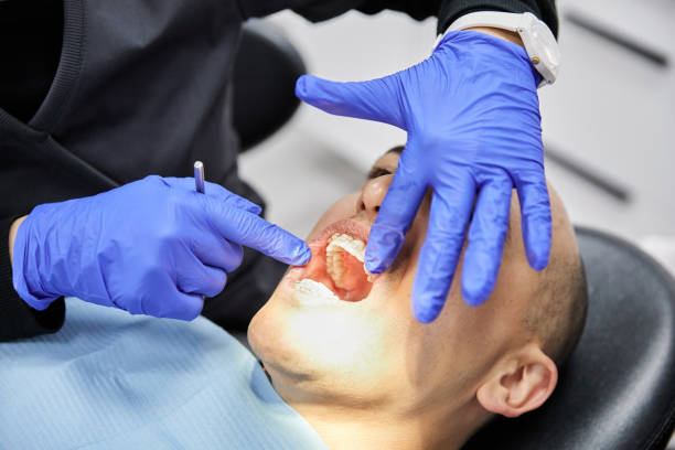 Best Emergency Dentist for Lost Fillings or Crowns in Tyndall Af, FL